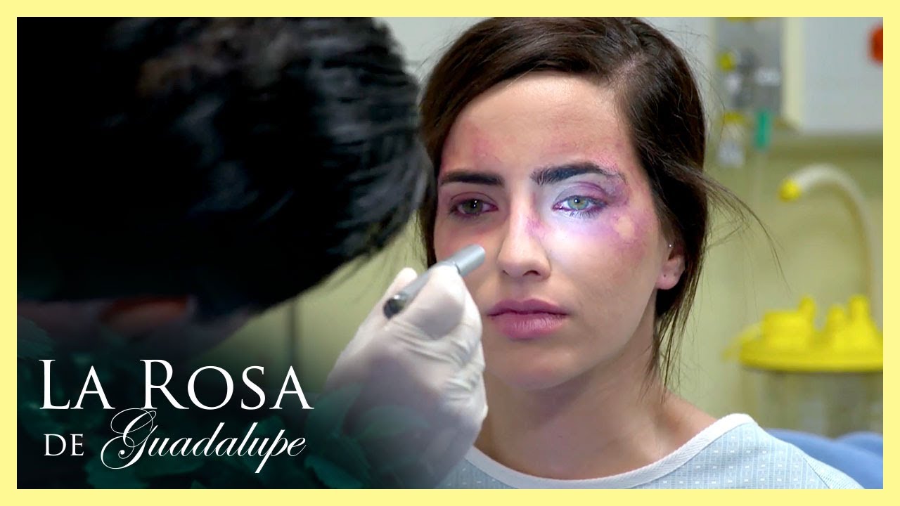 Azucena pierde la vista tras ser atacada con ácido